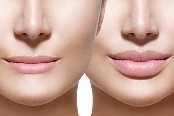 Why We Are Obsessed with Enhancing Our Lips