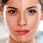 How To Do Skin Whitening?