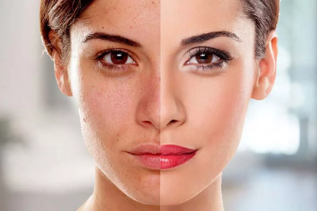 How To Do Skin Whitening?